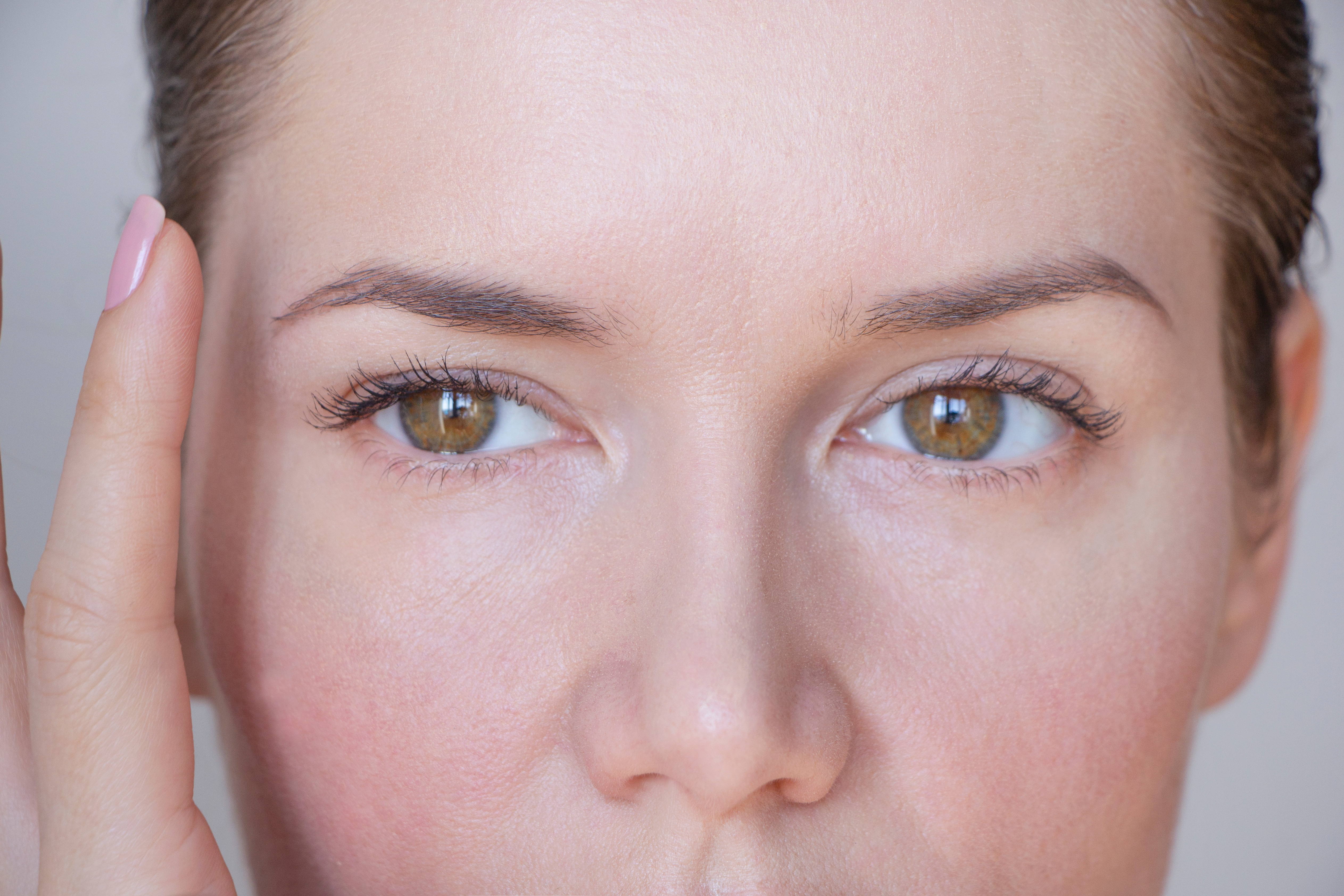 Ptosis